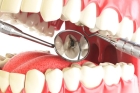 Лечение пульпита 3 канального зуба