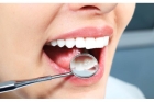 Реставрация эмали зуба
