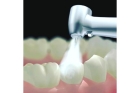 Пломбирование 2 канального зуба