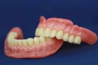 Съемные протезы на зубы