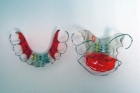 Пластины для исправления зубов