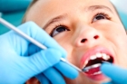 Лечение постоянных зубов у детей