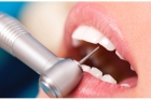 Лечение пульпита 4 канального зуба  