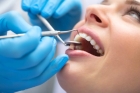 Лечение пульпита 3 канального зуба  