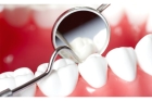 Лечение периодонтита 1 канального зуба  