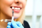 Косметическое восстановление зуба виниром 