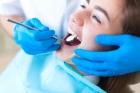 Восстановление формы зуба  