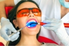 Пломбирование зуба композитной пломбой 