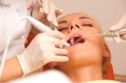 Резекция верхушки зуба 