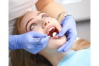 Резекция канала зуба