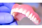 Пластиночное протезирование зубов 