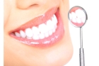 Протезирование зуба на 4 имплантах