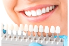 Съемный нижний зубной протез