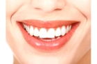 Пластины для выравнивания зубов взрослым 