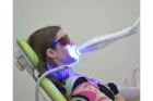 Отбеливание зубов системой Amazing white
