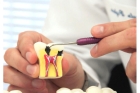Лечение пульпита 1-го канального зуба