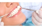 Лечение периодонтита 2-х канального зуба