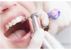 Профессиональная гигиена зубов
