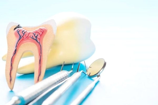 Лечение периодонтита 3 канального зуба  