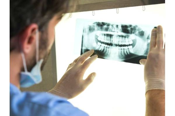 Рентген корней зубов  