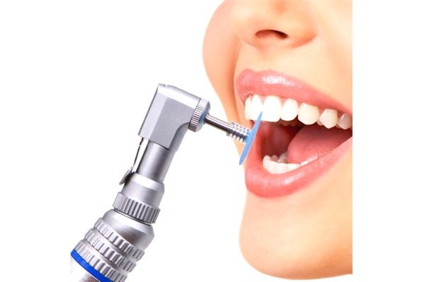 Чистка зубов кальцием