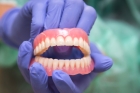 Полное протезирование зубов