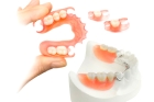 Пластиночное протезирование зубов