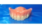 Протезирование верхних зубов