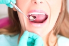 Удаление многокорневого зуба 