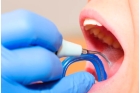 Ультразвуковая чистка зубов  