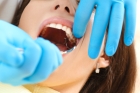 Удаление двухкорневого зуба