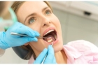 Рассрочка на имплантацию зубов 