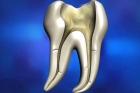 Пломбировка каналов (3-х канальный зуб)